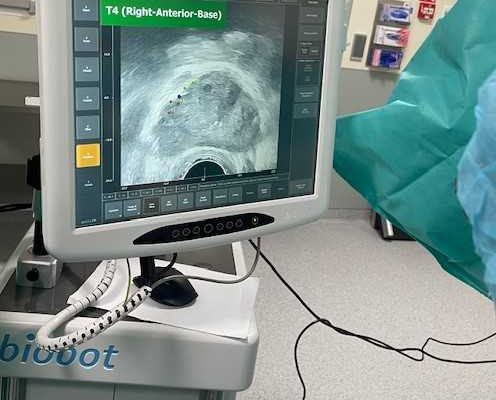 Monitor podłączony do robota Mona Lisa na sali operacyjnej wyświetla widok operacji.