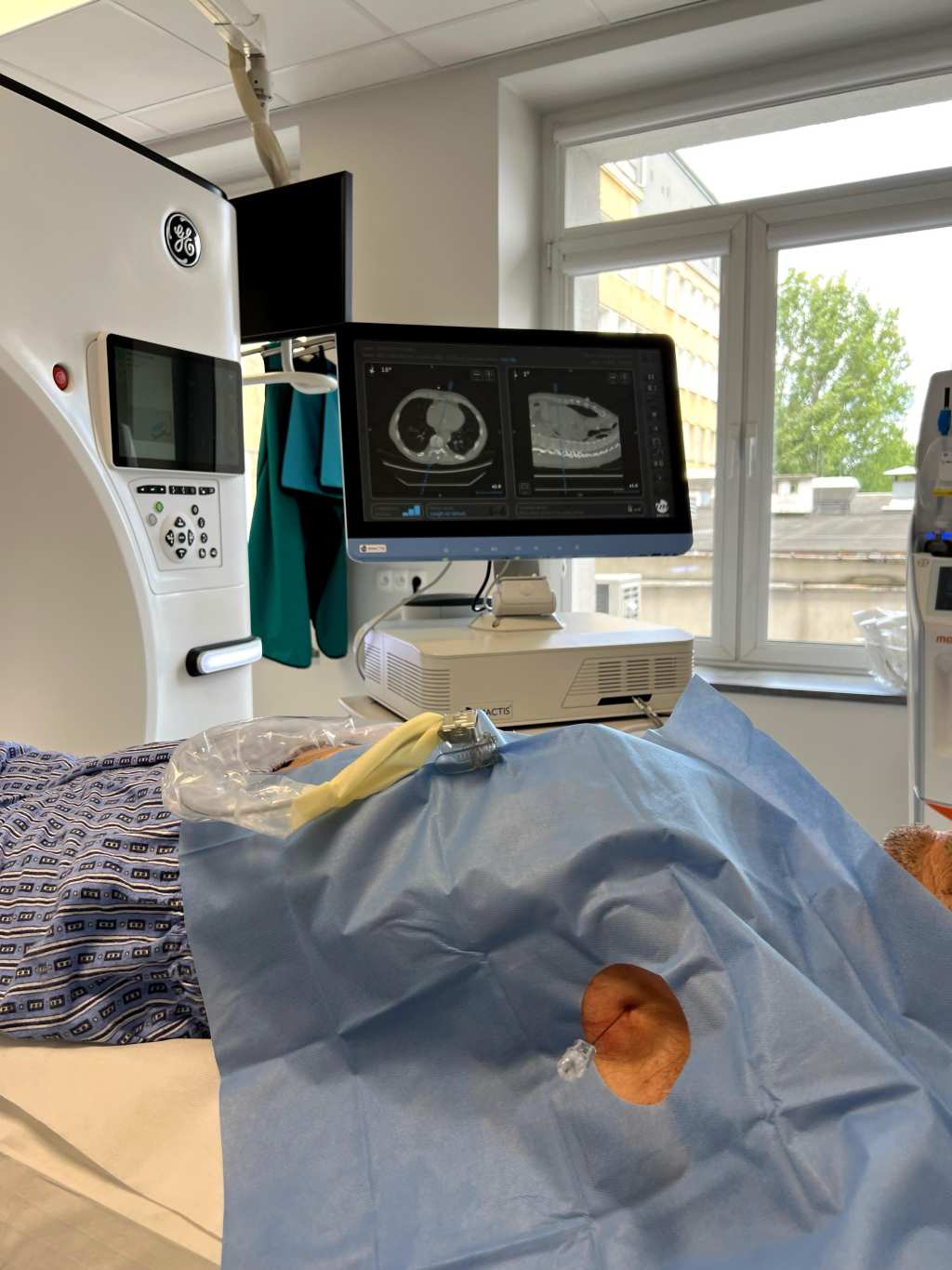 Pomieszczenie medyczne z tomografem komputerowym i monitorem wyświetlającym obrazy skanów. Pacjent leży przykryty niebieskim sterylnym prześcieradłem, a wejście znajduje się po jego stronie.