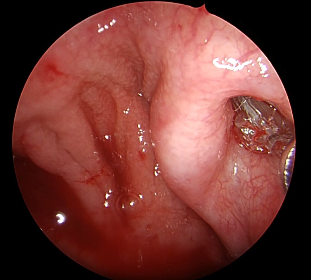Zdjęcie z kamery operacyjnej.