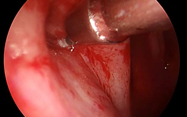 Zdjęcie z kamery operacyjnej.